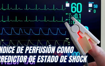 Índice de perfusión como predictor del estado de shock